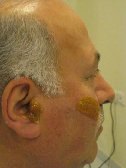 Before the Turkish wax.